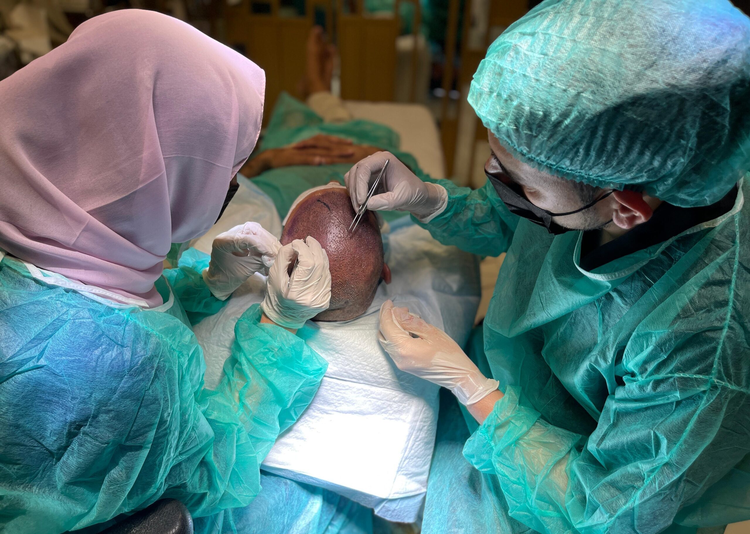 Man in his late twenties examining his hairline before considering a hair transplant
