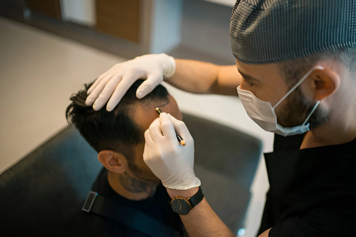 Hair transplant procedure at Estheticare Islamabad